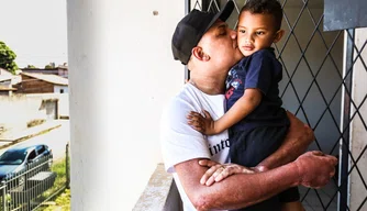 A pele da área queimada foi revitalizada.