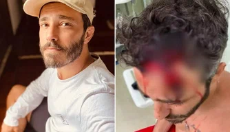 Ator Thiago Rodrigues.