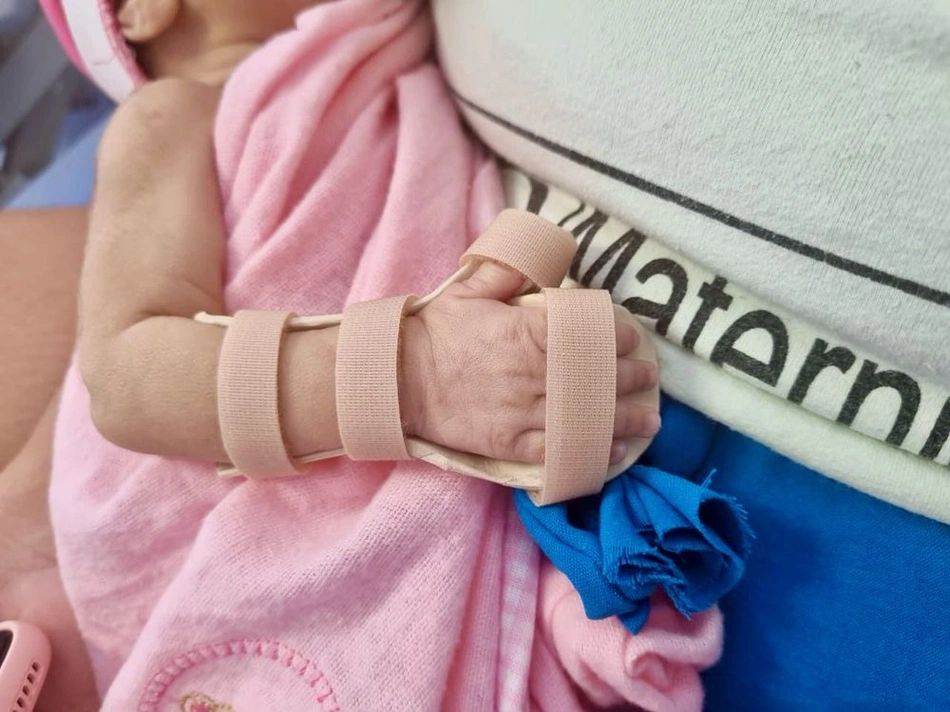 Nova Maternidade Dona Evangelina Rosa produz órteses para prematuros