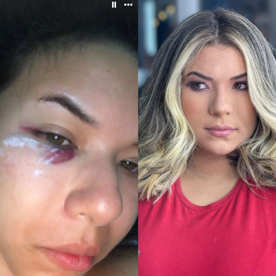 Jornalista denuncia agressão