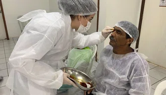 Mutirão de catarata em Teresina