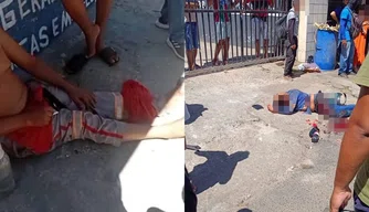 Homem atropelado por bandido em fuga relata indignação com atendimento do SAMU em Teresina