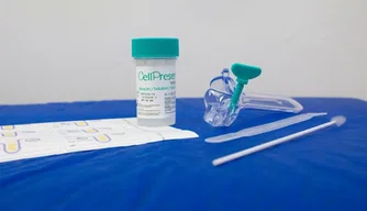 Novo método de diagnóstico de câncer de colo do útero