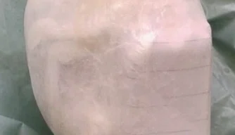 Um pacote introduzido no corpo da visitante.