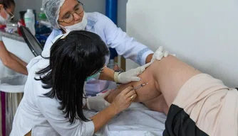 Mutirão de varizes da Sesapi realizou mais de 10 mil atendimentos no Piauí.