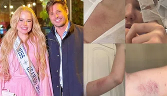 Suposta agressão sofrida por Miss Gramado Marcela Tomaszewski