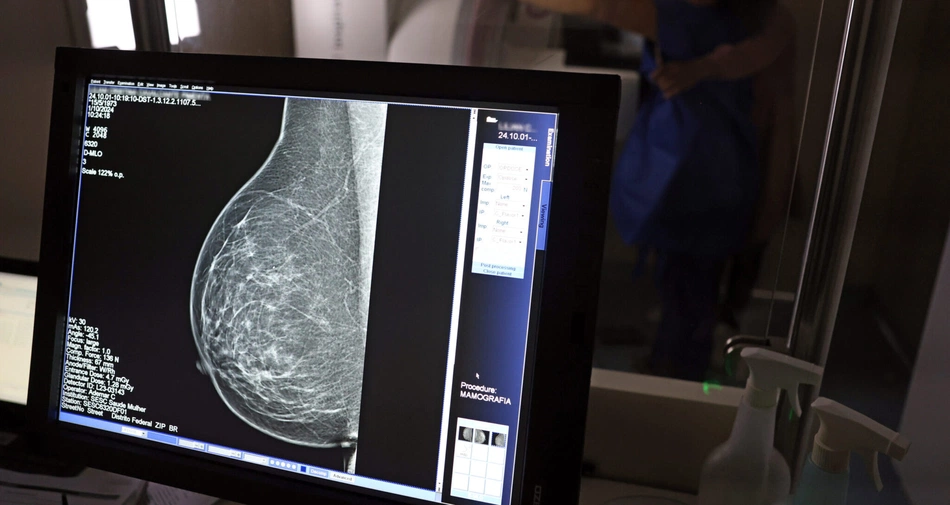 Teste de mamografia
