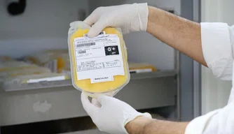 Hemopi recebe novos equipamentos do Novo PAC Saúde