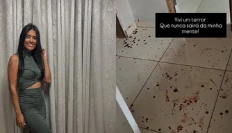 Vítima relatou ter sido espancada pelo ex-companheiro