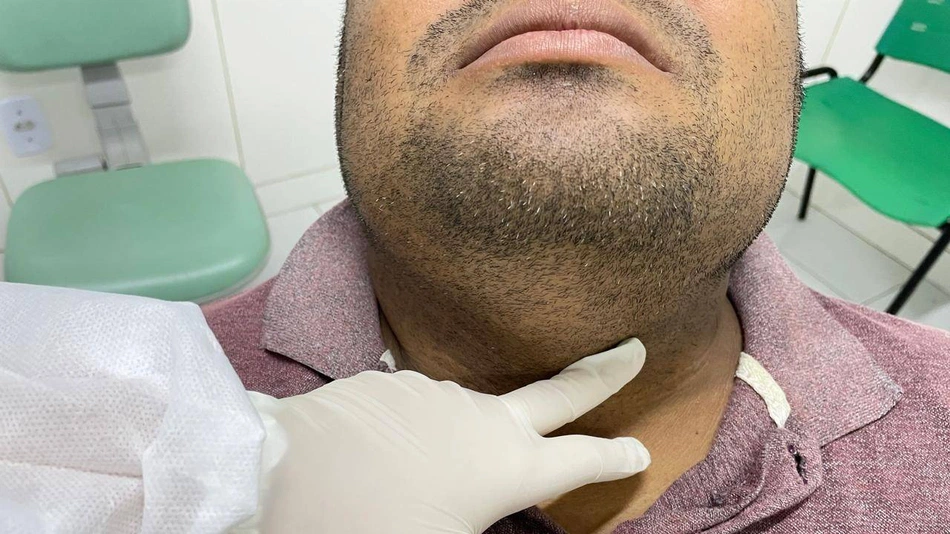 cancer bucal, boca