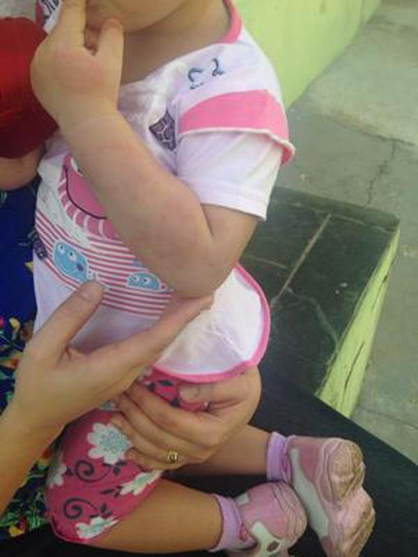 Dona da creche pode ser indiciada por lesão corporal culposa, quando não há intenção(Imagem:reprodução) Dona da creche pode ser indiciada por lesão corporal culposa, quando não há intenção(Imagem:reprodução)