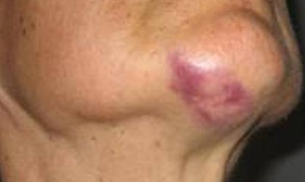 Marcas da agressão.(Imagem:Reprodução) Marcas da agressão.(Imagem:Reprodução)