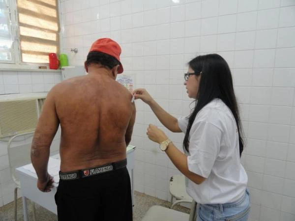 Teste de Hanseníase